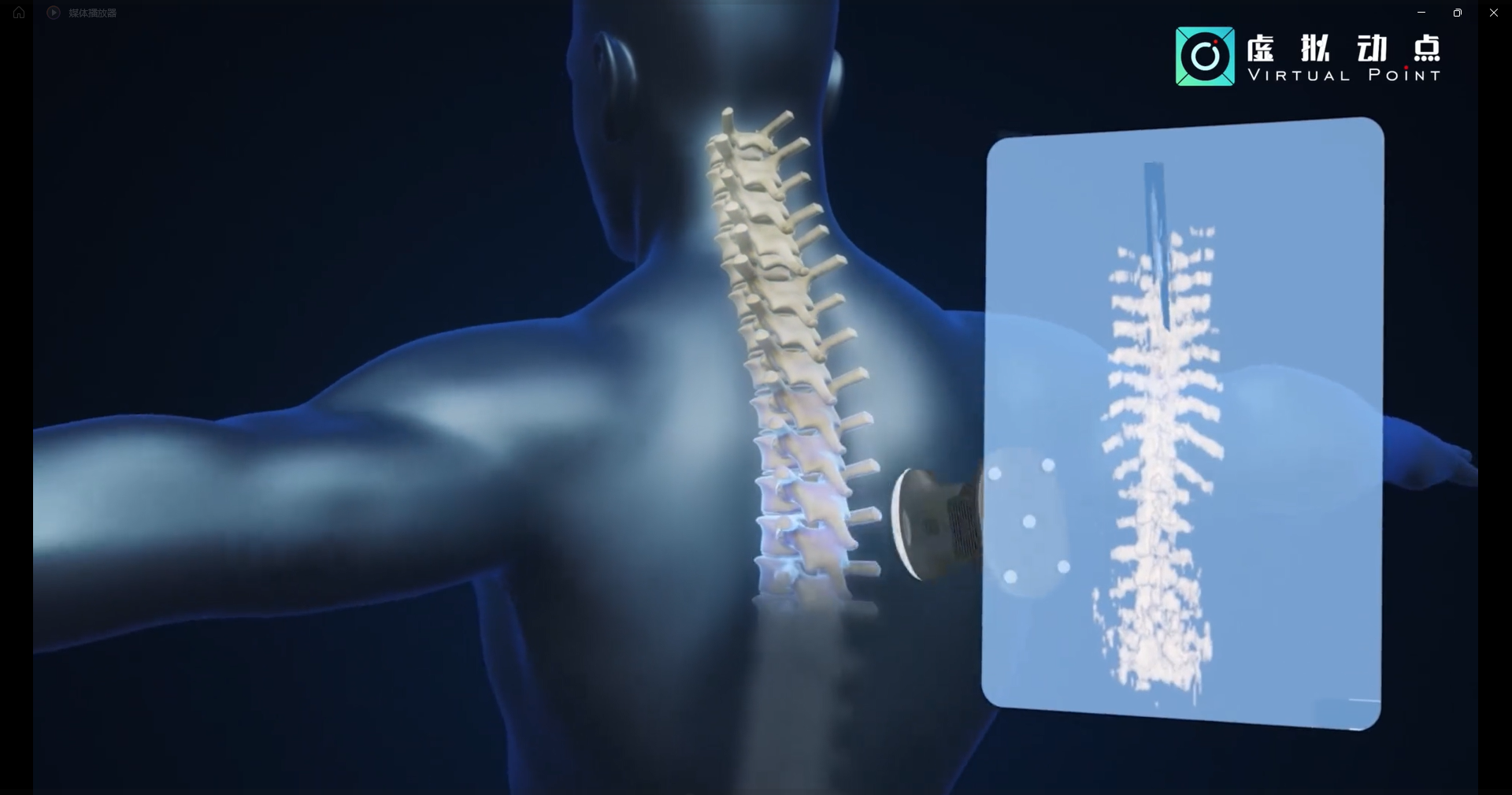 OptiTrack應用于3D超聲成像在脊柱診斷